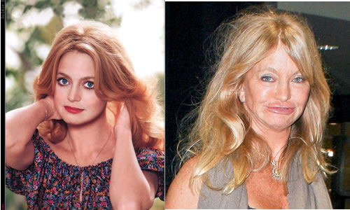 Antes e depois de 12 celebridades americanas-10