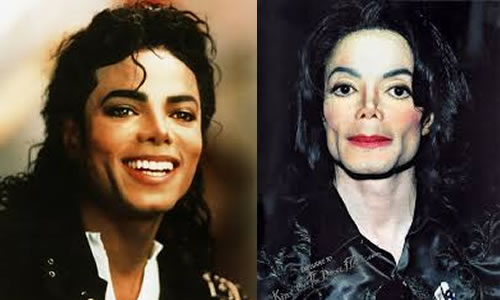 Antes e depois de 12 celebridades americanas-2