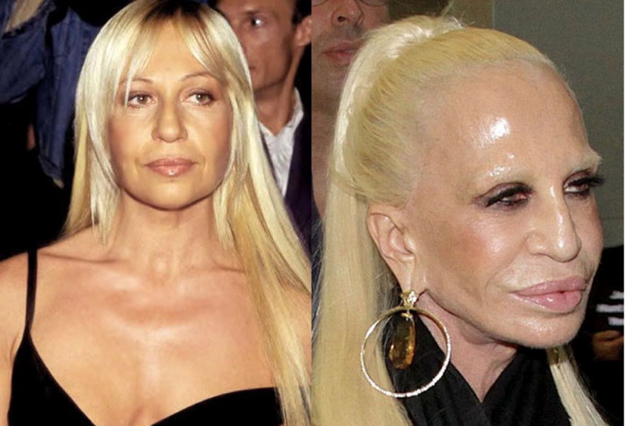 Antes e depois de 12 celebridades americanas-5