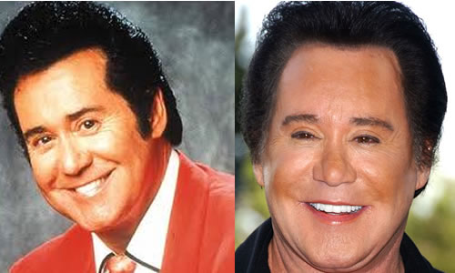 Antes e depois de 12 celebridades americanas-8